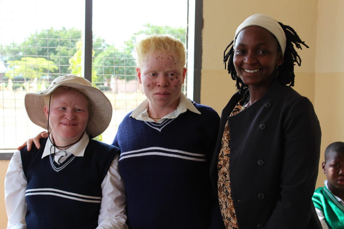 Fact: Albinos are Hunted in Africa